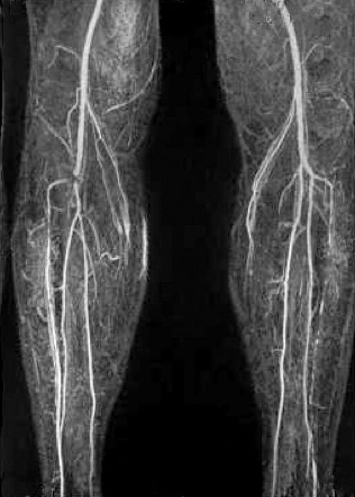 Vasculaire X-Ray